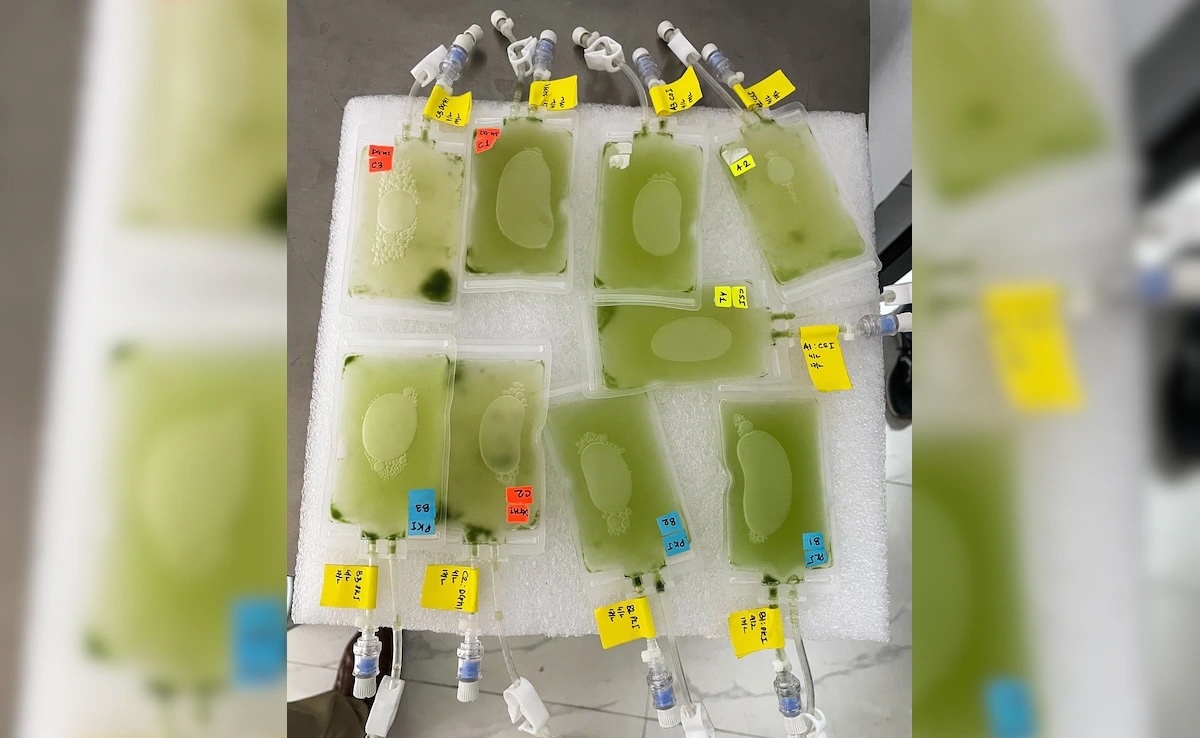 ar0d8itc-microalgae-growth-625x300-08-june-25