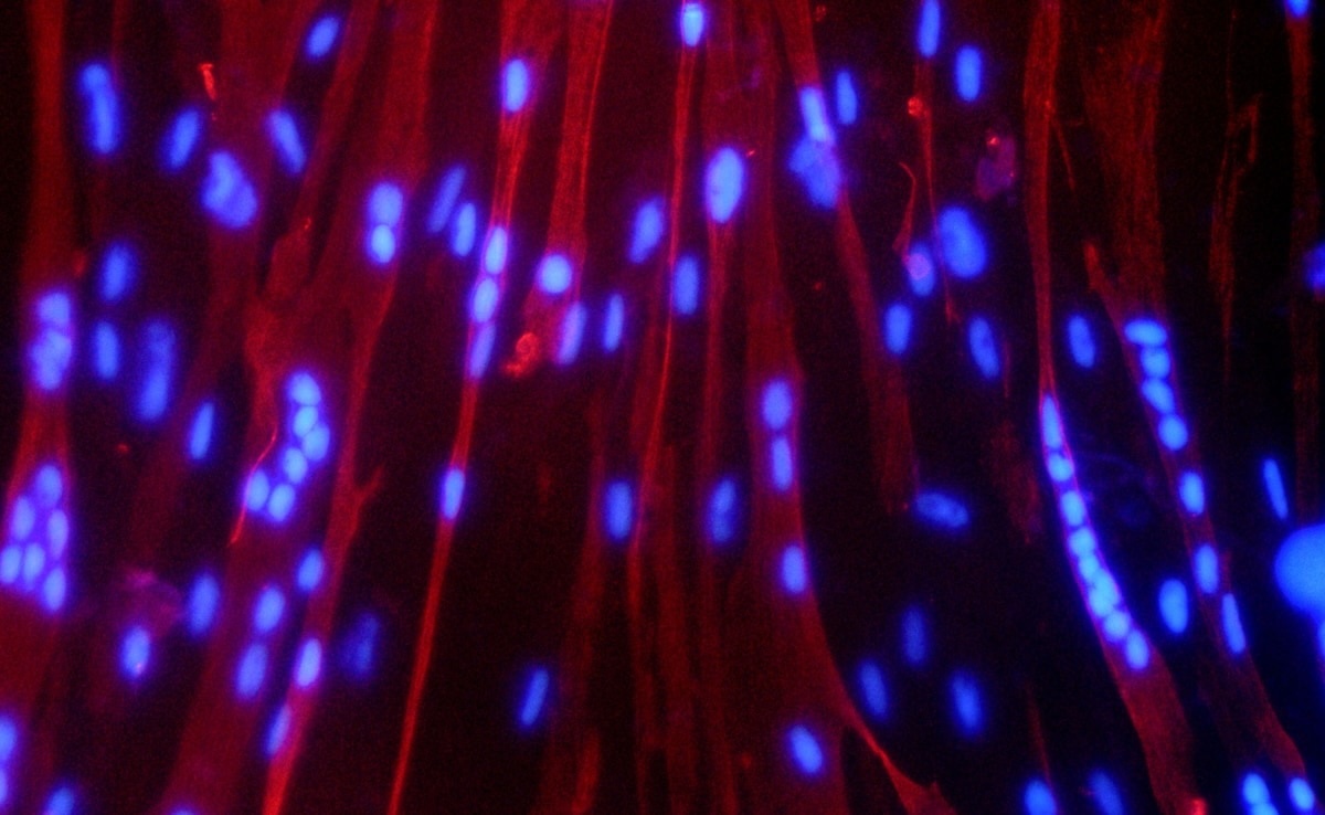 nk55edug-muscle-tissue-625x300-08-june-25